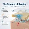 McKesson Hydrocolloid Dressings with Foam Backing, Sterile (10 Boxes, 100 Dressings Total) – Self-Adhesive Sterile Bandage, Waterproof Patch for Bed Sore, Mild Burn, Blister, Acne Care – 4 in x 4 in(4 x 4 Inch)