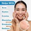 McKesson Puracyn Plus Skin and Wound Cleanser Spray, 8.5 oz Mist Bottle – HOCl Hypochlorous Acid Wound Wash for Cuts, Burns, Sores, Skin Irritations – Non-Sting First Aid Wound Spray