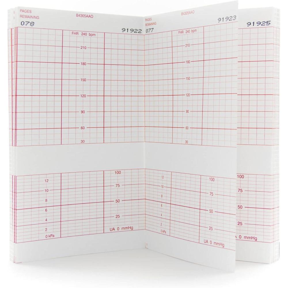 image:imageMcKesson Fetal Monitoring Paper Red Grid Thermal Paper 6 in x 47 ft 160 Count 1 Pack